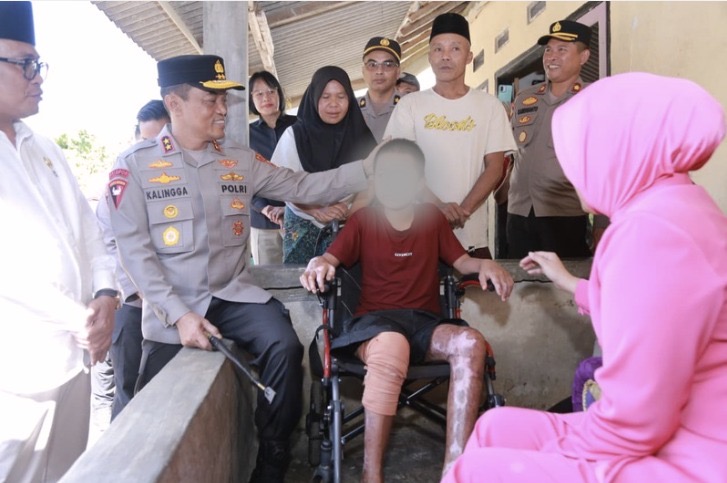 Kapolda NTB Irjen Pol. Kalingga Rendra Raharja mengunjungi korban kebakaran Ponpes Rosyidatus Shaulatiyyah, Selasa (7/7/2026).Selain memberikan santunan, rombongan memastikan pendampingan pendidikan dan proses hukum atas kejadian ini.